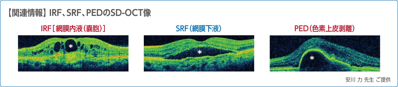 関連情報 関連情報