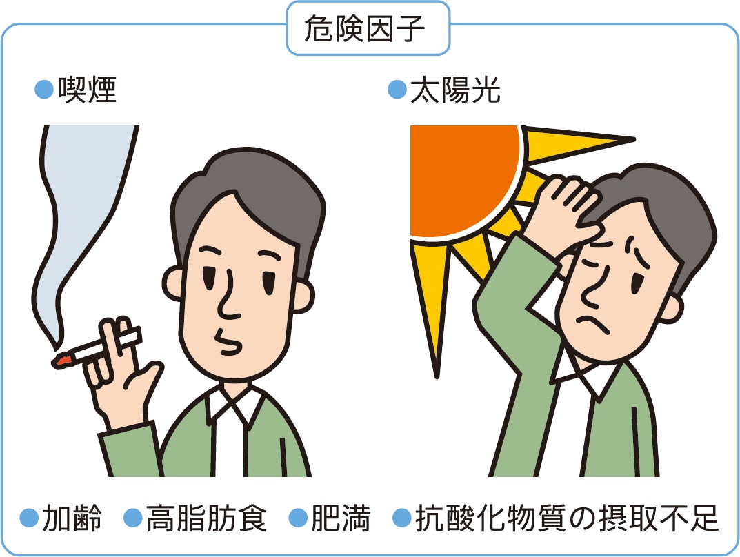 危険因子