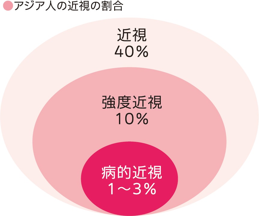 アジア人の近視の割合