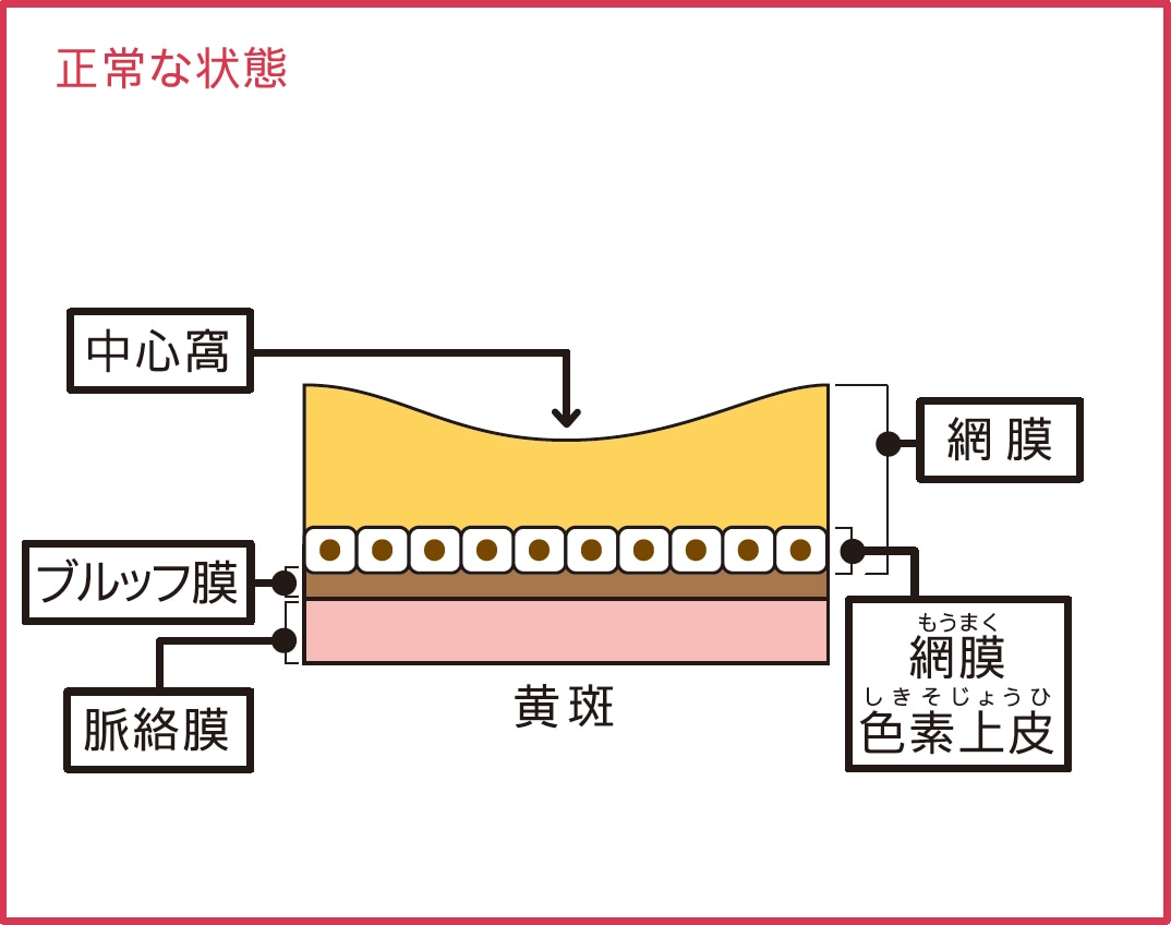 正常な状態