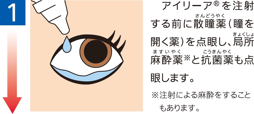 治療当日のながれ1 治療当日のながれ1