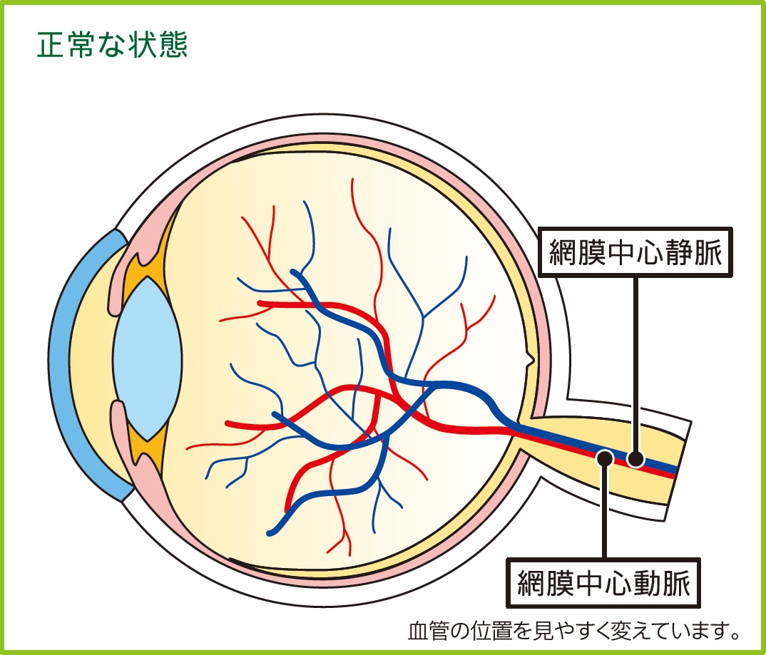 正常な状態