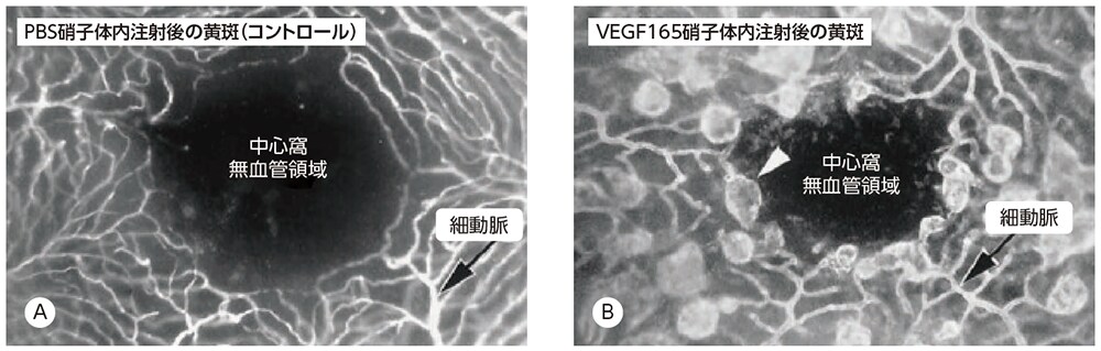 VEGF165投与による黄斑の変化