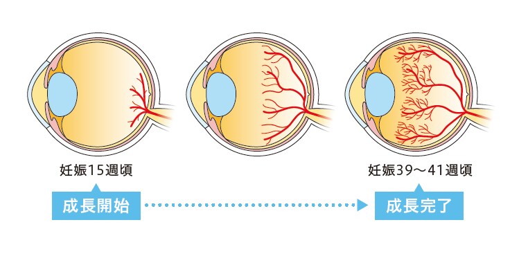網膜血管の成長｜未熟児網膜症｜患者さんとご家族の方へ｜Eylea.jp