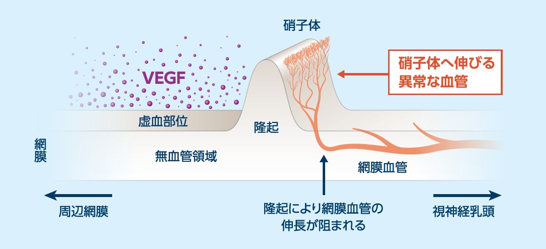 ROPとVEGFのイラスト