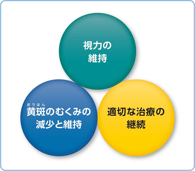 加齢黄斑変性の管理のイラスト