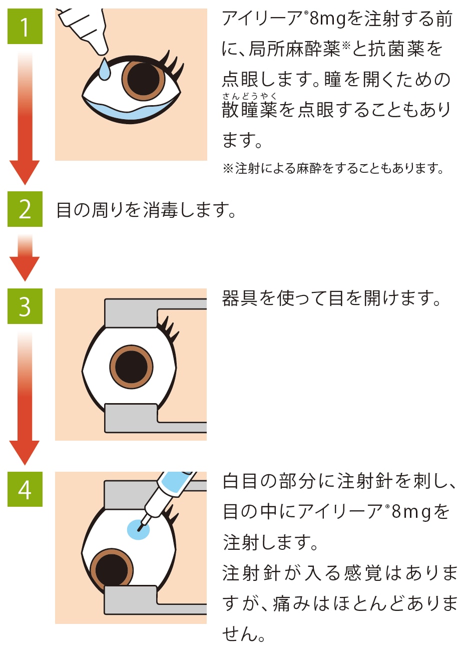 投与方法の手順イラスト